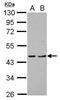 Programmed cell death protein 2 antibody, LS-C155195, Lifespan Biosciences, Western Blot image 