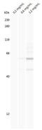 Tax1 Binding Protein 3 antibody, H00030851-M01, Novus Biologicals, Western Blot image 