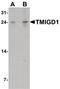 Transmembrane And Immunoglobulin Domain Containing 1 antibody, PA5-38057, Invitrogen Antibodies, Western Blot image 