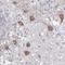 Paired Like Homeodomain 3 antibody, NBP1-92274, Novus Biologicals, Immunohistochemistry paraffin image 