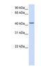 Parvin Beta antibody, NBP1-59135, Novus Biologicals, Western Blot image 