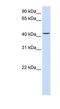 Parvin Beta antibody, NBP1-59135, Novus Biologicals, Western Blot image 