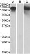 GPRIN Family Member 3 antibody, 42-815, ProSci, Enzyme Linked Immunosorbent Assay image 