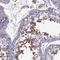 Solute Carrier Family 2 Member 3 antibody, HPA006539, Atlas Antibodies, Immunohistochemistry frozen image 
