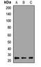 Tumor protein D52 antibody, LS-C667979, Lifespan Biosciences, Western Blot image 