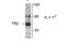 Thyroid Hormone Receptor Beta antibody, MBS833212, MyBioSource, Western Blot image 