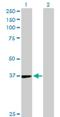 Tissue Specific Transplantation Antigen P35B antibody, H00007264-D01P, Novus Biologicals, Western Blot image 