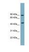 Sphingomyelin Phosphodiesterase 2 antibody, NBP1-59936, Novus Biologicals, Western Blot image 