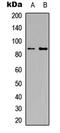 Interleukin 4 Receptor antibody, LS-C356124, Lifespan Biosciences, Western Blot image 