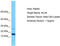 Killin, P53 Regulated DNA Replication Inhibitor antibody, TA330877, Origene, Western Blot image 