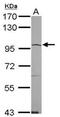 Angiotensin I Converting Enzyme 2 antibody, 19505, QED Bioscience, Western Blot image 