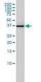 Aldo-Keto Reductase Family 1 Member A1 antibody, H00010327-M01, Novus Biologicals, Western Blot image 