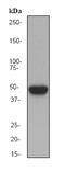 Keratin 16 antibody, ab76416, Abcam, Western Blot image 