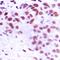 Mesenchyme Homeobox 2 antibody, orb214243, Biorbyt, Immunohistochemistry paraffin image 