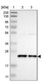 Yip1 Interacting Factor Homolog A, Membrane Trafficking Protein antibody, PA5-53240, Invitrogen Antibodies, Western Blot image 