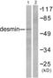 Desmin antibody, abx013058, Abbexa, Western Blot image 