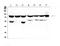 Protein Kinase C Beta antibody, A01940, Boster Biological Technology, Western Blot image 