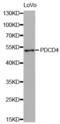 Programmed Cell Death 4 antibody, abx002007, Abbexa, Western Blot image 