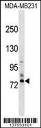 Sodium Channel Epithelial 1 Delta Subunit antibody, 59-370, ProSci, Western Blot image 