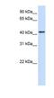 ECPTP antibody, NBP1-62412, Novus Biologicals, Western Blot image 