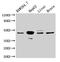 Mitogen-Activated Protein Kinase Kinase 4 antibody, LS-C369968, Lifespan Biosciences, Western Blot image 