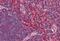C-X-C Motif Chemokine Receptor 6 antibody, MBS242091, MyBioSource, Immunohistochemistry paraffin image 