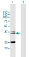 T Cell Receptor Alpha Constant antibody, H00006955-B01P, Novus Biologicals, Western Blot image 