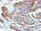 Caldesmon 1 antibody, M04578, Boster Biological Technology, Immunohistochemistry paraffin image 