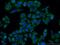 Transmembrane Protein 106B antibody, 20995-1-AP, Proteintech Group, Immunofluorescence image 