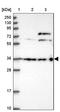 DDB1 And CUL4 Associated Factor 4 antibody, PA5-61485, Invitrogen Antibodies, Western Blot image 