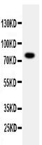 Protein Phosphatase 1 Regulatory Subunit 15B antibody, GTX12081, GeneTex, Western Blot image 