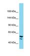 Putative neuroblastoma breakpoint family member 24 antibody, orb327034, Biorbyt, Western Blot image 