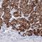 V-Set And Immunoglobulin Domain Containing 1 antibody, NBP1-81073, Novus Biologicals, Immunohistochemistry paraffin image 