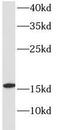 Hemoglobin Subunit Delta antibody, FNab03769, FineTest, Western Blot image 