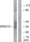 Olfactory Receptor Family 5 Subfamily D Member 13 (Gene/Pseudogene) antibody, A18796, Boster Biological Technology, Western Blot image 