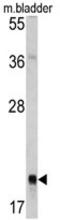 RAB13, Member RAS Oncogene Family antibody, AP17693PU-N, Origene, Western Blot image 