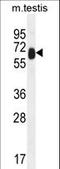 Tetratricopeptide Repeat Domain 39B antibody, LS-C160301, Lifespan Biosciences, Western Blot image 