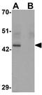 Kruppel Like Factor 4 antibody, GTX17306, GeneTex, Western Blot image 
