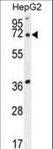Acyl-CoA Thioesterase 11 antibody, LS-C155943, Lifespan Biosciences, Western Blot image 
