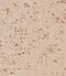 Interferon Alpha And Beta Receptor Subunit 1 antibody, A00306, Boster Biological Technology, Immunohistochemistry paraffin image 