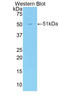 Cadherin 13 antibody, LS-C302625, Lifespan Biosciences, Western Blot image 