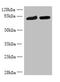 DDHD Domain Containing 2 antibody, A58742-100, Epigentek, Western Blot image 