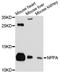 Natriuretic Peptide A antibody, A11848, ABclonal Technology, Western Blot image 