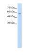 RANBP2-Type And C3HC4-Type Zinc Finger Containing 1 antibody, orb325054, Biorbyt, Western Blot image 