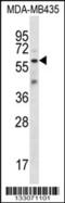 Fascin Actin-Bundling Protein 3 antibody, 56-844, ProSci, Western Blot image 