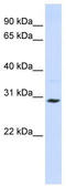 CAC antibody, TA334169, Origene, Western Blot image 