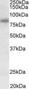 Serologically Defined Colon Cancer Antigen 8 antibody, MBS422897, MyBioSource, Western Blot image 