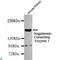 Angiotensin I Converting Enzyme antibody, LS-C814092, Lifespan Biosciences, Western Blot image 