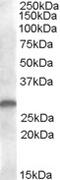 C-Type Lectin Domain Family 1 Member B antibody, MBS422159, MyBioSource, Western Blot image 