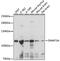 DNA Methyltransferase 3 Alpha antibody, 16-769, ProSci, Western Blot image 